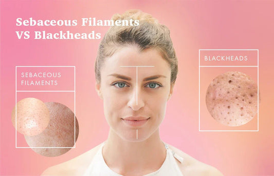 Blackheads or Sebaceous Filaments? Here’s How to Spot the Difference