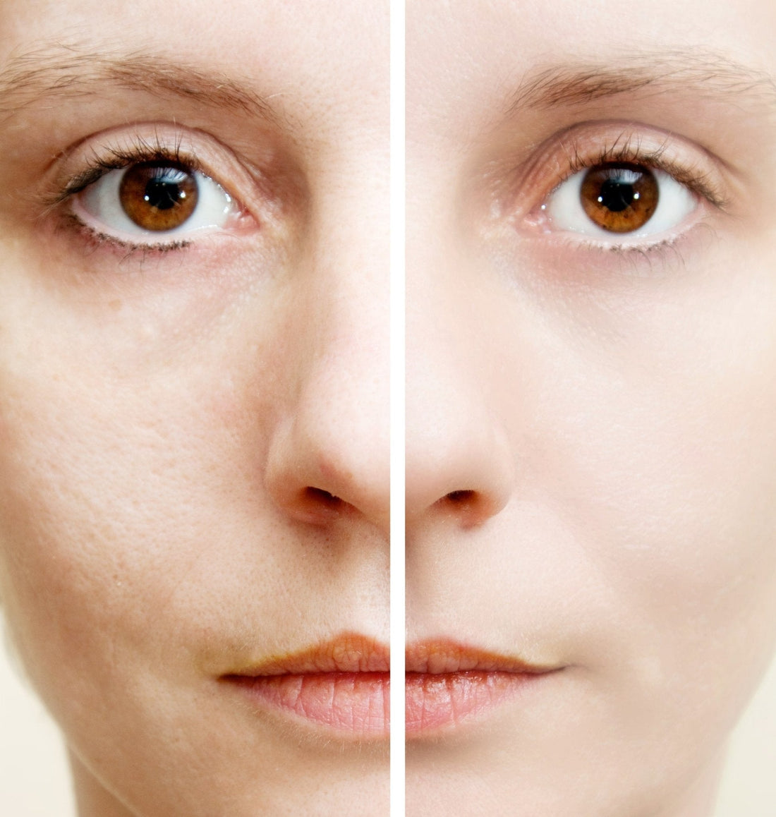 Struggling with uneven skin? Learn expert skin retexturing tips with Tu Cereza.
