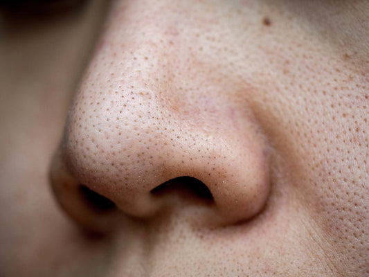 Why Are My Pores So Big? How to Minimize Them